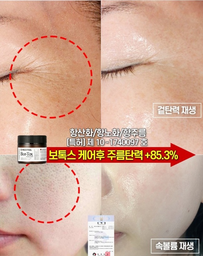 바르는 보톡스 펩타이드 보르톡스 주름 볼륨 탄력 재생... | 헬로마켓