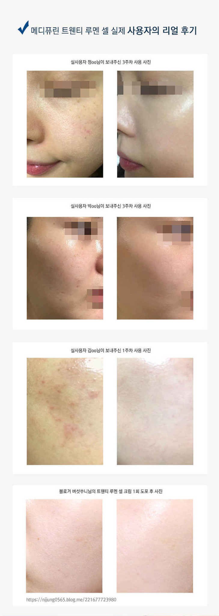 효과100보장)1회만발라도 기미 잡티 주름 탄력 한번에해결 (98000)