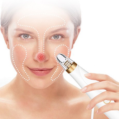 전동 피지제거기 블래헤드 피지흡입기