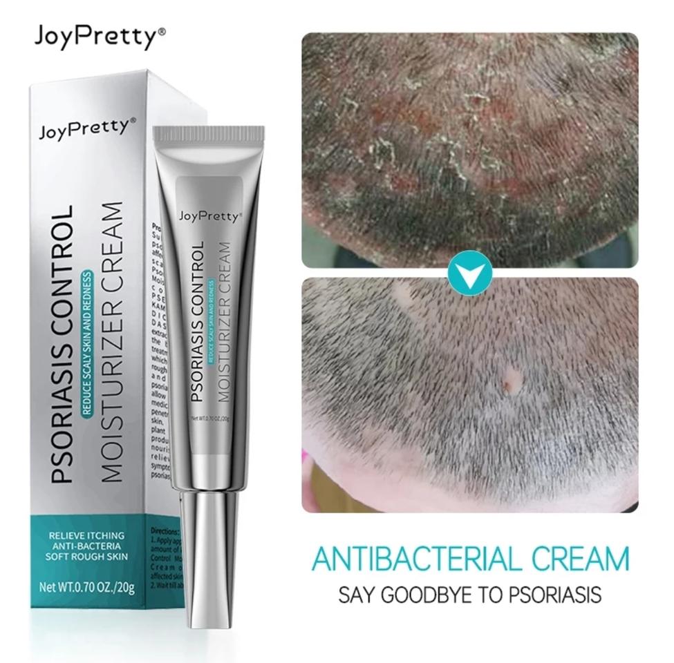 2일무료배송 유럽브랜드 항균 크림 건선 진균 연고 모낭염 습진 피부염