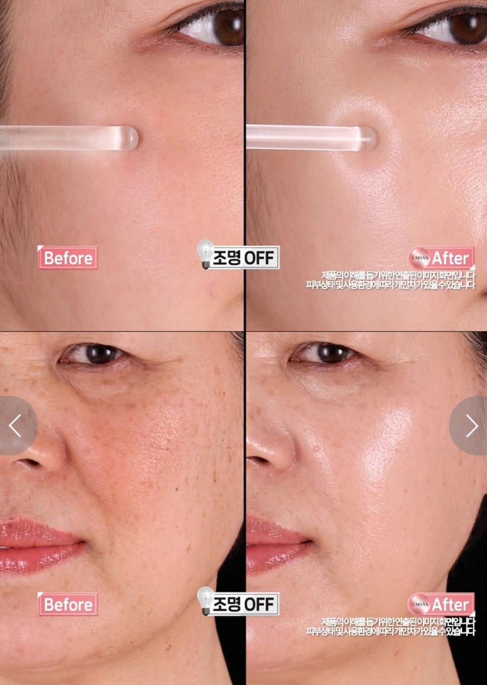 일시적X 기미 완치없는 불치병? 이제는 No 뿌리깊은 속 기미까지 파괴