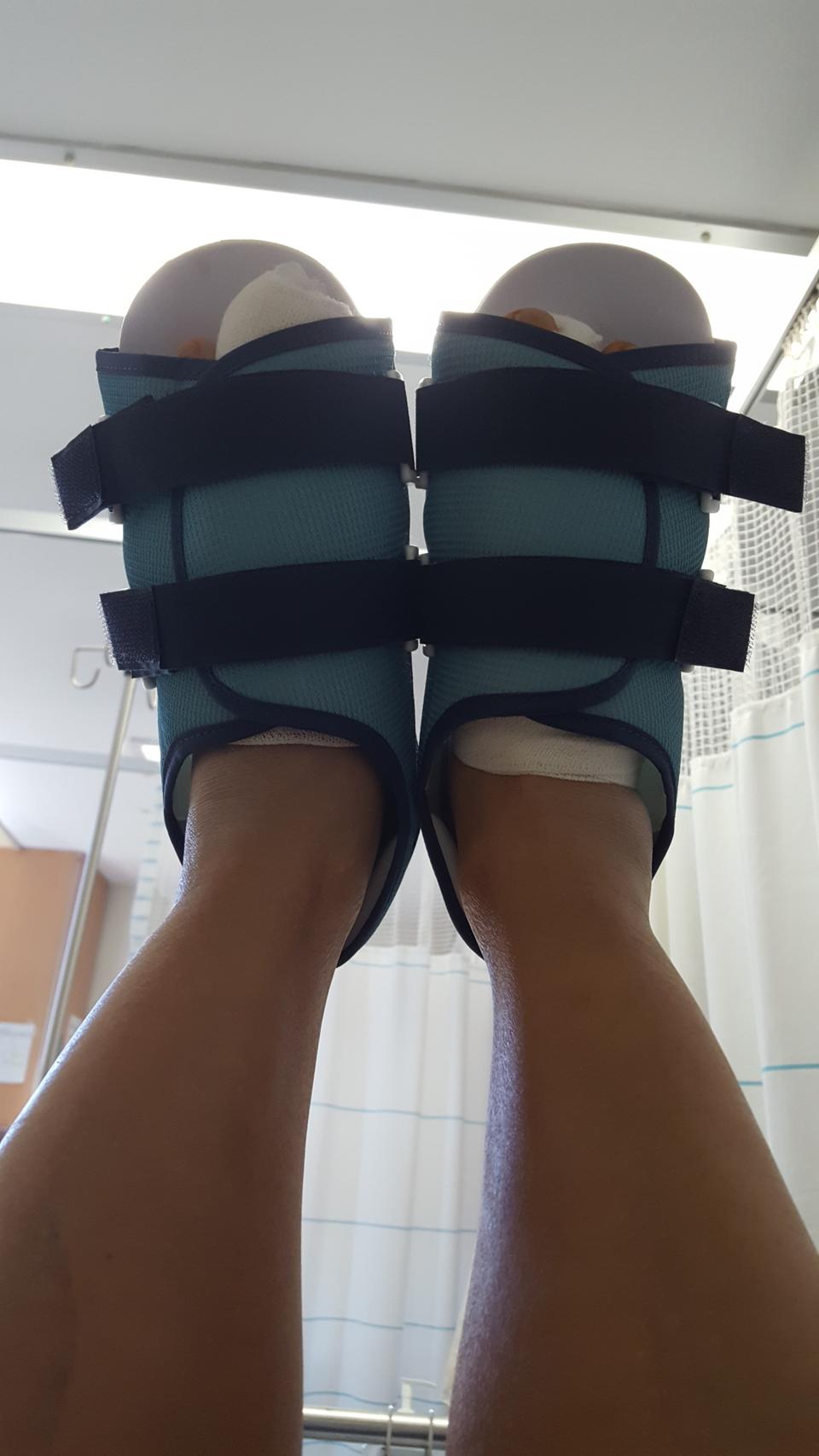 무지외반보정신발