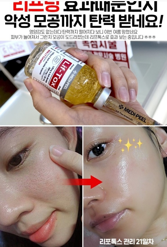 이유리 리프팅 톡스볼륨 콜라겐실리프팅 주름 모공 탄력광채 메디필 화장품