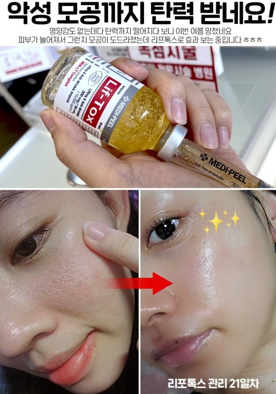 이유리 리프팅 톡스 미친 볼륨 콜라겐실리프팅 주름 모공 탄력광채 메디필