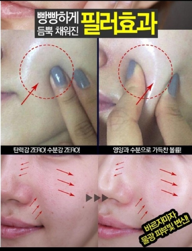 메디필 저분자생콜라겐/볼륨,탄력복원 광채,재생복원 수분,손상된피부 화장품