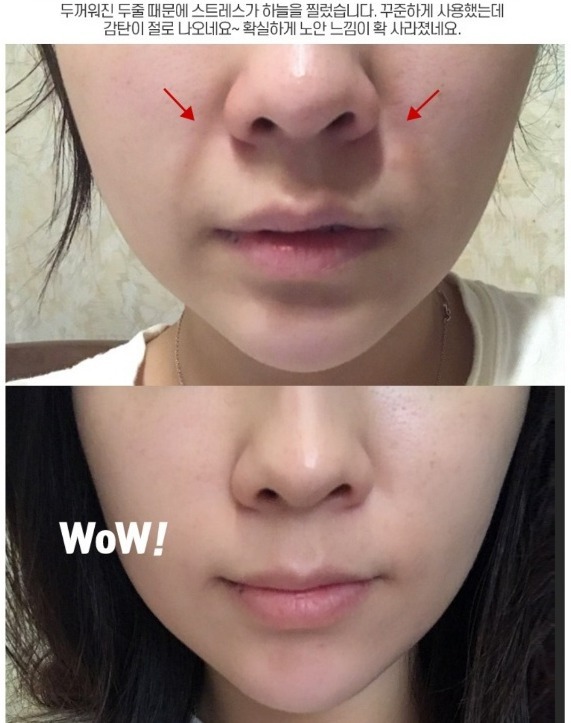 이유리 리프팅 톡스볼륨 콜라겐실리프팅 주름 모공 탄력광채 메디필 화장품