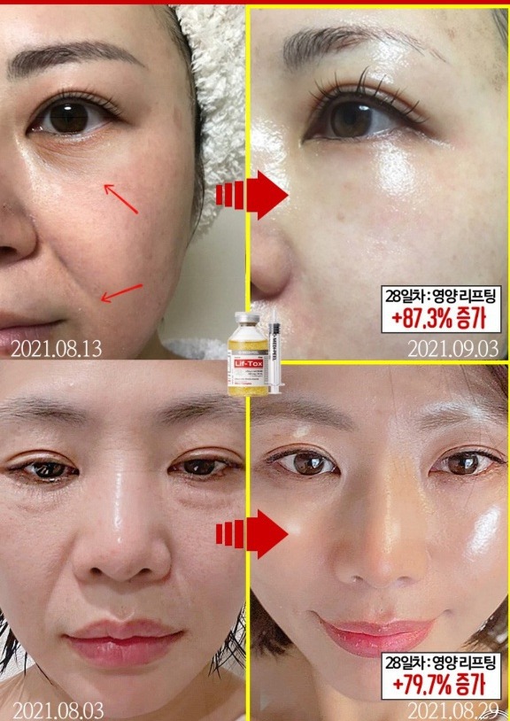 이유리 리프팅 톡스 미친 볼륨 콜라겐실리프팅 주름 모공 탄력광채 화장품