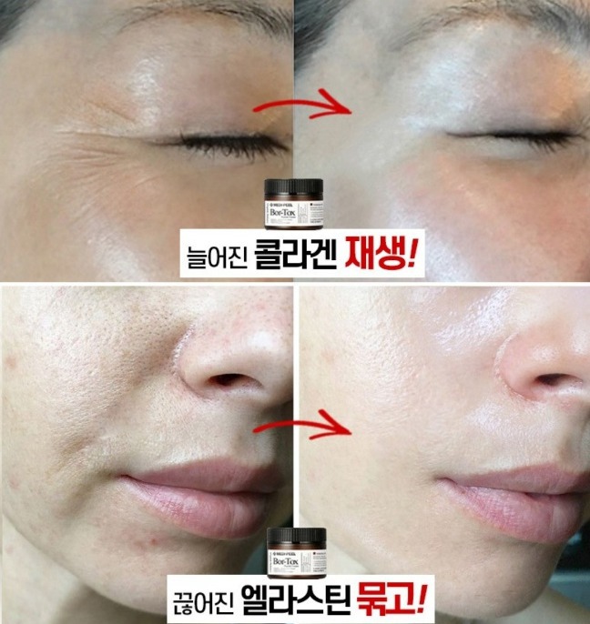 바르는 보톡스 펩타이드 보르톡스 주름 볼륨 탄력 재생 메디필 크림화장품