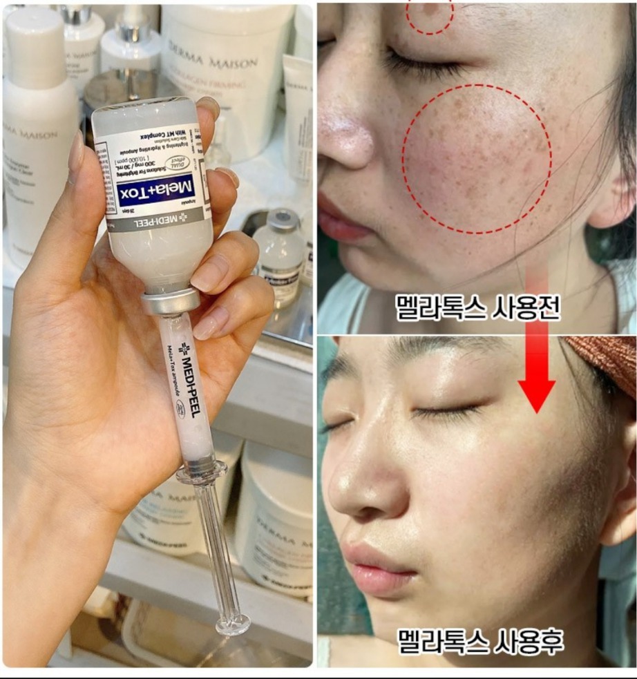 줄기세포 미백앰플 기미 잡티 피부톤업 색소침착 주근깨 메디필 화장품에센스