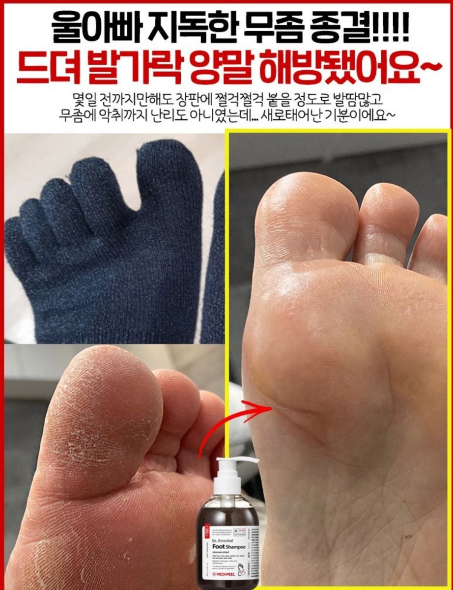 아기발 발냄새 발습진 각질 무좀 보습 한번에 한방 목초액 풋 샴푸 화장품