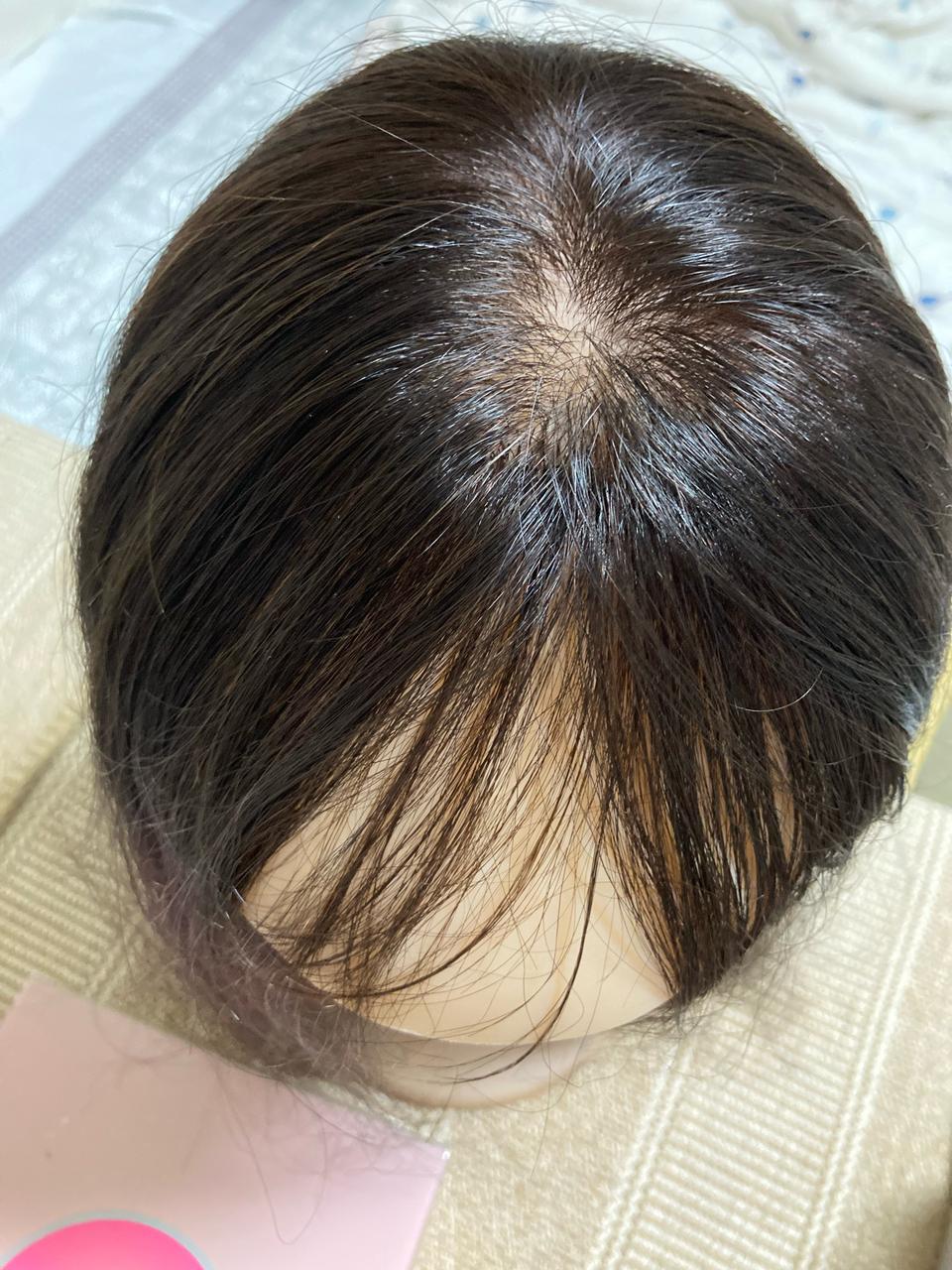 인모정수리가발