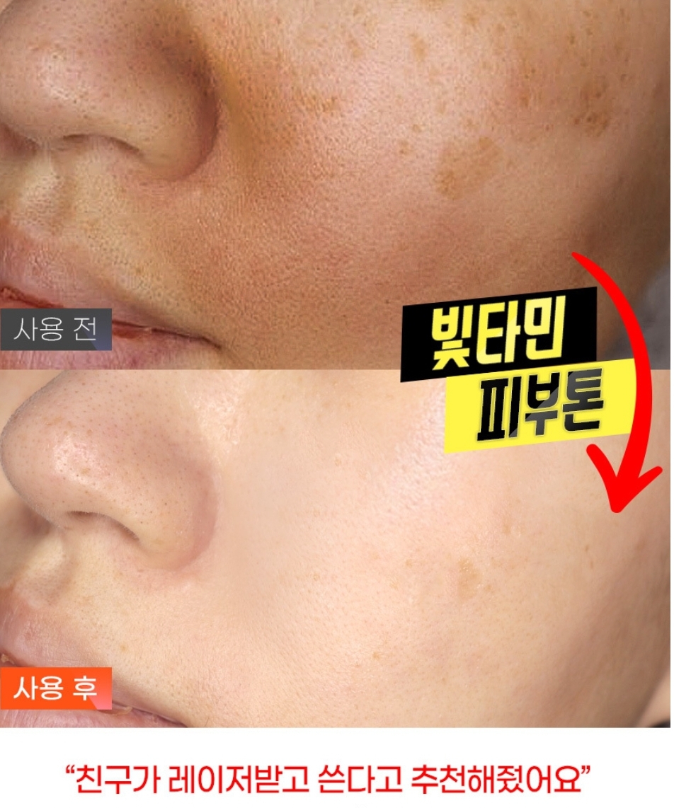 잔주름 진한기미,잡티,주근깨 미백 지우개 히알루론산 물광 화이트닝 앰플