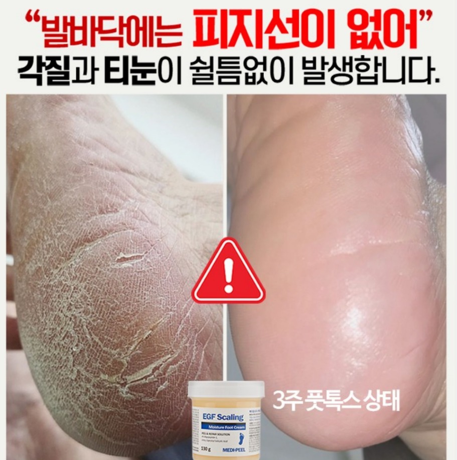메디필 풋크림 발각질 무좀 티눈 굳은살 발보습 아기발완성 화장품