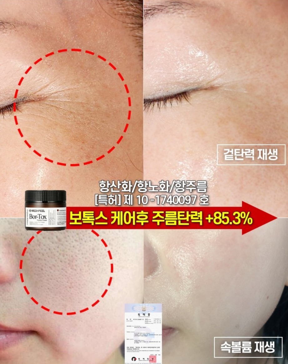 바르는 보톡스크림 펩타이드 보르톡스 주름 볼륨 탄력  메디필 크림 앰플