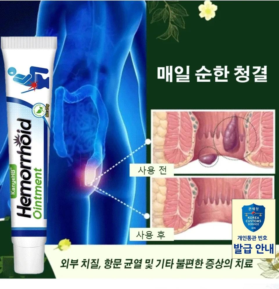 2일무료배송 치질 크림 효과 극대화 제품 연고