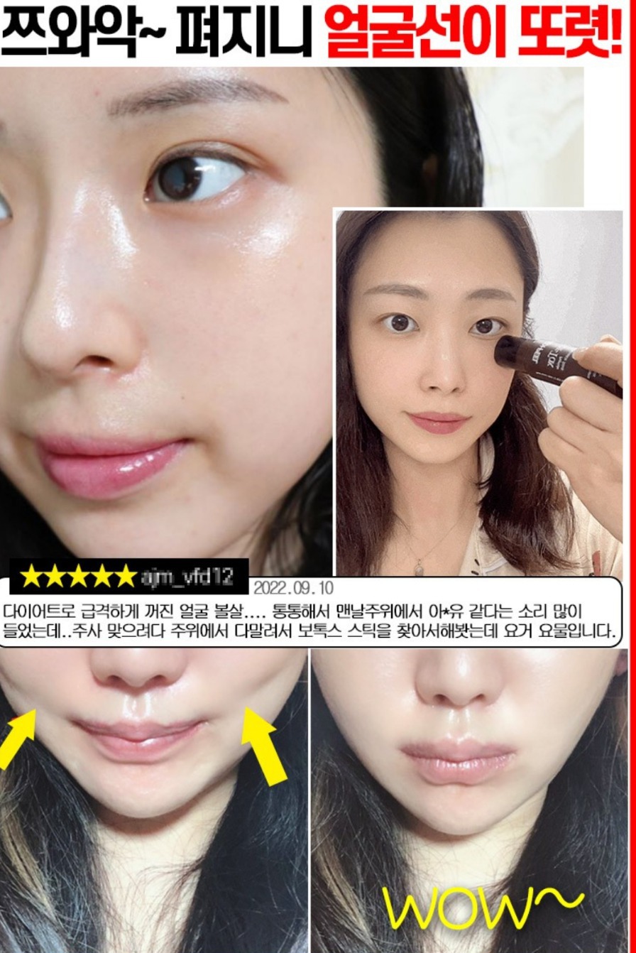 메디필 보톡스 시술스틱볼륨 미백 보톡스 스틱 화장품 탄력크림