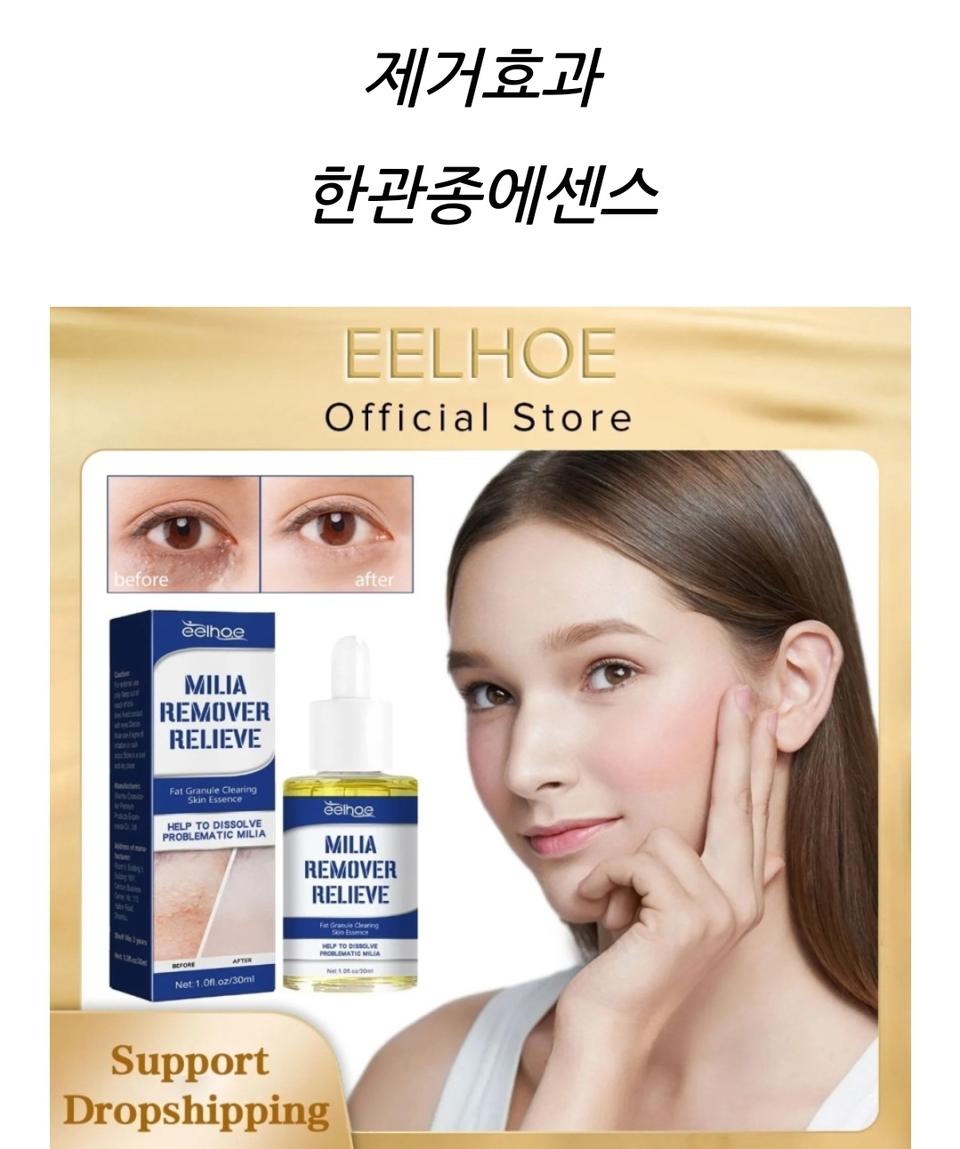 2일무료배송 비립종 제거 연고 율무크림 한관종