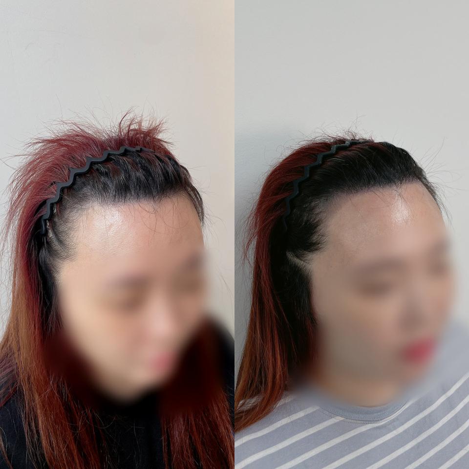 두피문신 체험 모델 모집