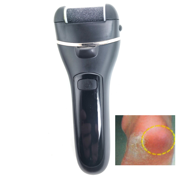 발각질제거기 전동각질제거기 굳은살제거기 무료배송